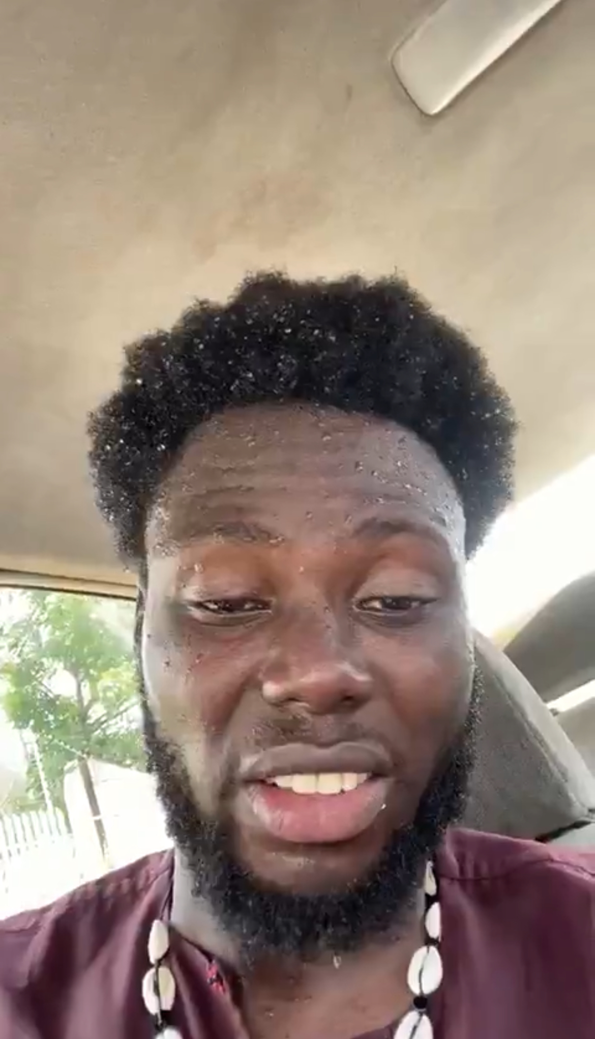 #EndSARS: Police Attack Protesters in Abuja